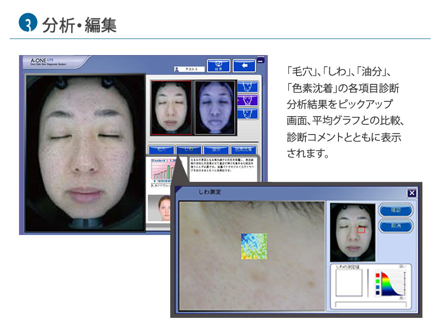 肌診断機器 A-ONE Lite（エイ・ワン・ライト） | ㈱神戸メディケア